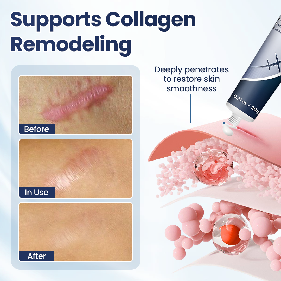 🔥Last Day Discount🔥 Nexisify® DERMALUX Texture Repair Gel